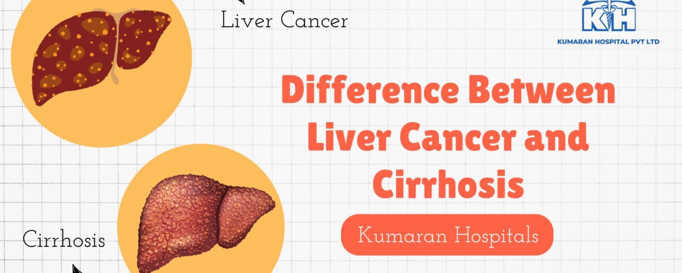 Difference Between Liver Cancer and Cirrhosis